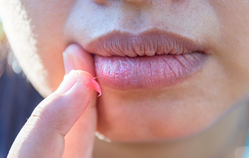 Liệu trị thâm môi bằng vitamin C có thực sự hiệu quả?